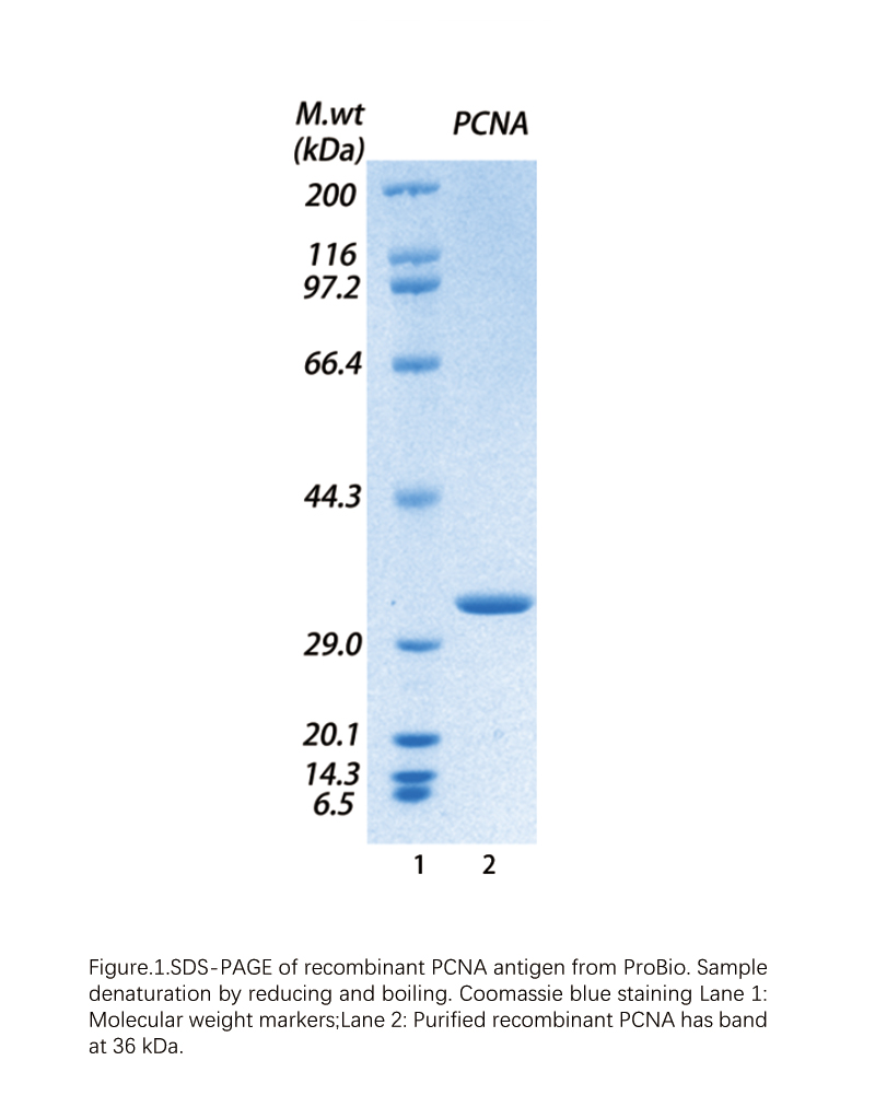 PCNA